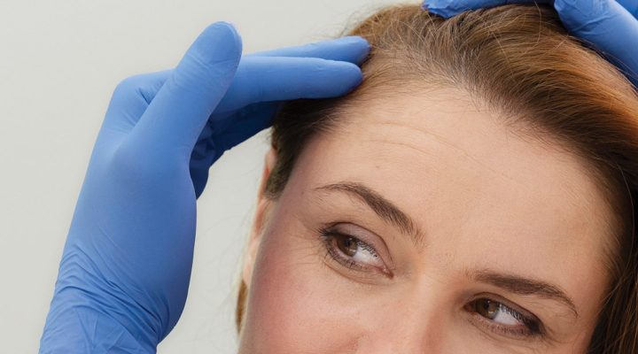 Clinician wearing blue gloves touching a woman's hair at the hairline (close-up)
