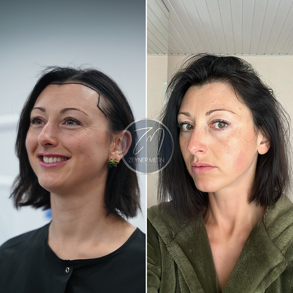 zeynep-metin-sonuc-19