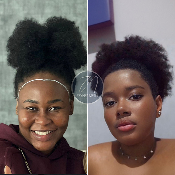 zeynep-metin-sonuc-20