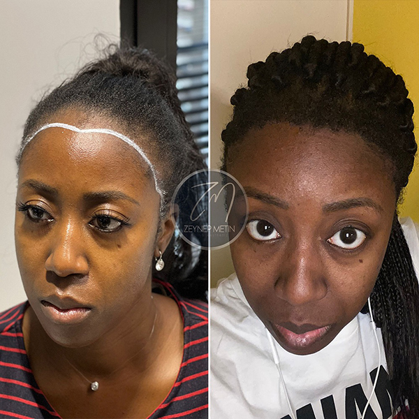 zeynep-metin-sonuc-5