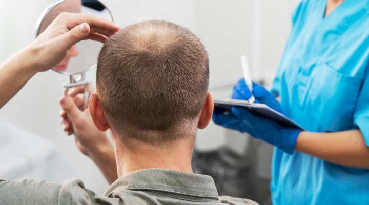 Patient facing away as a clinician in blue scrubs examines the scalp with a mirror and takes notes on a clipboard nearby.