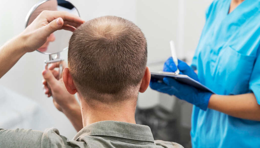 Patient facing away as a clinician in blue scrubs examines the scalp with a mirror and takes notes on a clipboard nearby.
